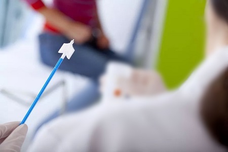 Kohdunkaulan syövän seulonnan edistys: Itsekalvon HPV-testien rooli