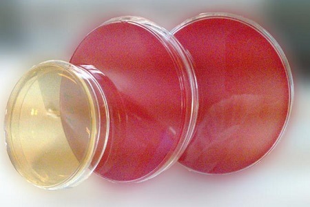 Salmonella Shigella -agar (SS): välttämätön väliaine patogeenin eristämiselle