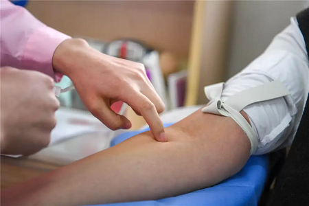 Babio esittelee nopean lavantaudin IgG/IgM-testisarjan luotettavalle hoitopistediagnostiikkalle