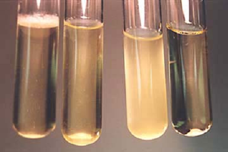 Babio lanseeraa tehokkaan aivosydäninfuusioliemen Global Microbiology Labsille