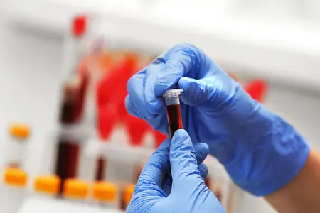 BABIO lanseeraa naudan fluoresenssiraskaustestin