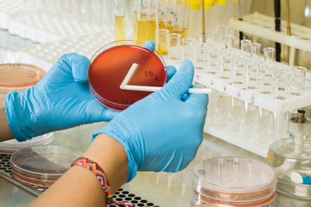 BABIO's MacConkey Agar Medium – ensiluokkainen selektiivinen eristys maailmanlaajuiseen mikrobiologiseen diagnostiikkaan