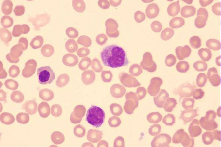 Porsaiden paratyphoidrokotealusta eläinlääkintärokotteiden tuotantoon